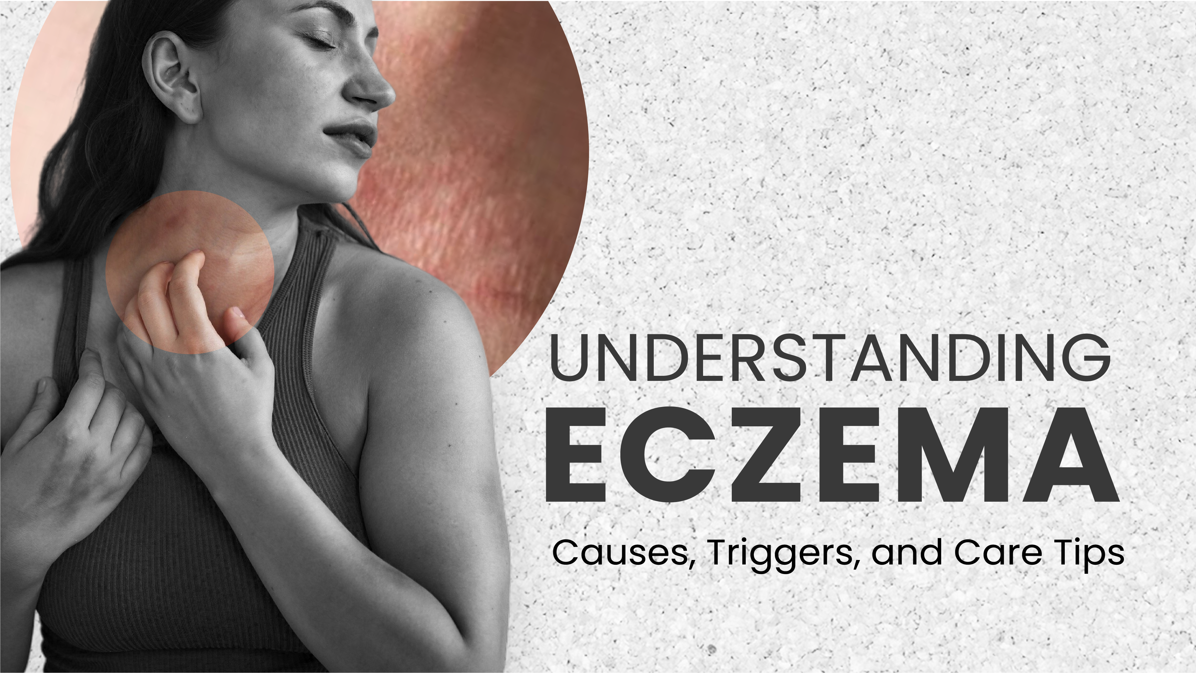 Understanding Eczema: Causes, Triggers, and How to Care for Eczema-Prone Skin