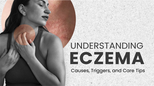 Understanding Eczema: Causes, Triggers, and How to Care for Eczema-Prone Skin