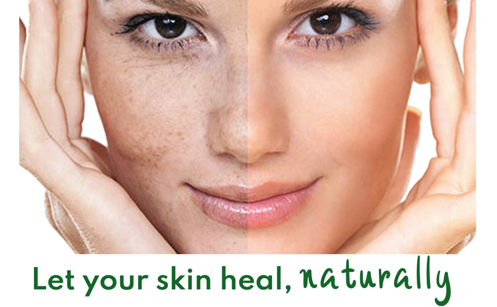 Before and after images showing the effectiveness on dark spots.