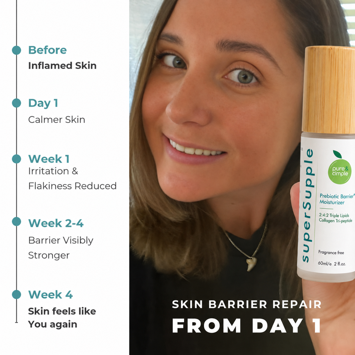 superSupple Prebiotic Triple Lipid Moisturizer
